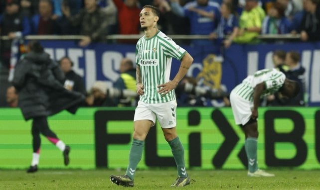 Antony, brazos en jarra